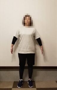 30代女性のビフォー