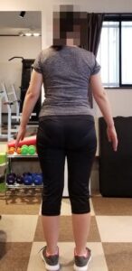 40代女性のビフォー